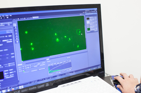 Parasites that come from the mosquito make circular motions perfectly measured to invade blood cells and enter the liver. Scientists at USF are working to develop a vaccine to stop the parasite's motility and to stop them from entering liver cells. 