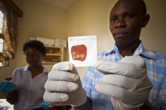David Oguttu holds blood samples collected from children to determine if they were ever exposed to onchocerciasis.