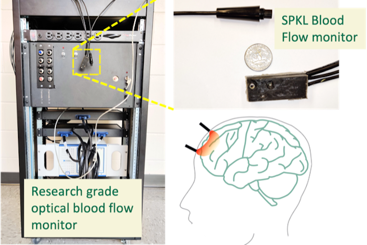 The SPKL blood flow monitor is the size of a pack of gum.